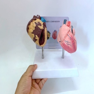 Tıbbi bilimler karşılaştırma insan kalp patoloji modeli Organ hastalığı modeli Anti ilaç modeli - Product Image 4