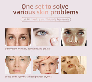 Appareil de beauté pour le visage 4 en 1 de qualité supérieure pour usage domestique, en ABS, sans aiguille, pour le rajeunissement de la peau et l'élimination des poches sous les yeux - Product Image 4