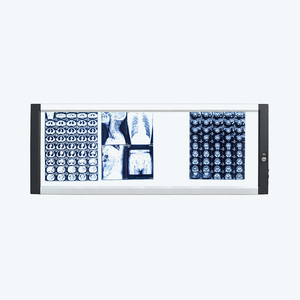 Negatoscope LED DQ-4B à quadruple LED pour <span class=keywords><strong>canal</strong></span> optique, luminosité réglable 120W - Product Image 2