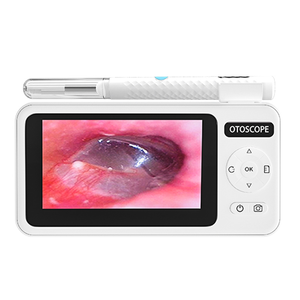 เครื่องมือกำจัดขี้หู T29 Visual Wi-Fi พร้อมหน้าจอ IPS ขนาด 4.3 นิ้ว กล้องดิจิตอลตรวจหูในตัว เลนส์กล้องความละเอียดสูง 1080P ขนาด 3.9 มม. สำหรับการดูแลคนและสัตว์เลี้ยง - Product Image 1