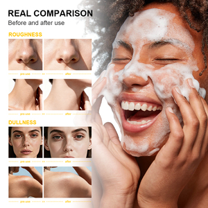 Savon en granulés de papaye, exfoliation enzymatique à la papaïne, affinement de la texture, antioxydant, éclaircissant, réparation de la barrière, régulation de l'acné - Product Image 5