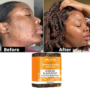 สบู่ดำสำหรับสิวจากแอฟริกันออร์แกนิกสบู่ดำช่วยลดจุดด่างดำช่วยปรับสมดุลผิวมัน - Product Image 6