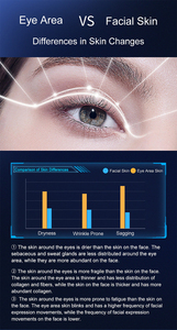Nouvel appareil de beauté pour les yeux 2025 – Machine de cryolifting pour l'élimination des poches sous les yeux et le lifting du visage - Product Image 2