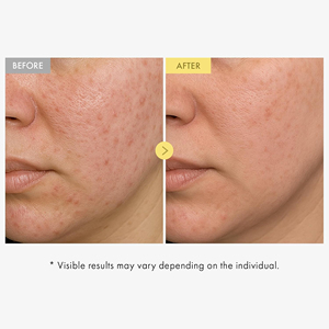 Sérum pour le visage à la <span class=keywords><strong>propolis</strong></span> et à la niacinamide, naturel et doux, hydratant et apaisant pour les peaux irritées et inégales, OEM ODM - Product Image 4