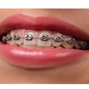 Hot Items Orthodontic Standard MBT 018 Brackets Dental Machinery Power Source - Product Image 5