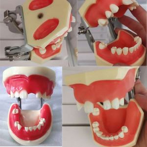 Modello di impianto dentale KyrenMed con edentulismo parziale nelle mascelle superiori e inferiori denti modello di pratica mancante - Product Image 2