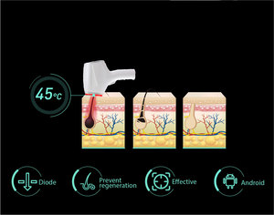 2024 Tốt Nhất Chuyên Nghiệp Diode 755 Tẩy Lông Bằng Laser 808 1064 1200W Diode Máy Tẩy Lông Bằng Laser Giá - Product Image 5