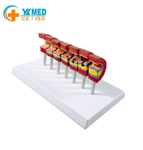 Modelo de Enseñanza de Anatomía Humana para Ciencias Médicas: Pie Diabético para Educación en Endocrinología y Patofisiología, Escuela de Medicina - Product Image 1