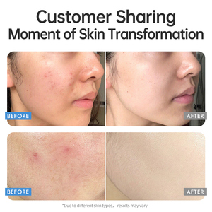 Private Label Fornecedor Coreano Cápsula Gel Creme OEM 3D Cuidados Com A Pele Colágeno Vitamina Profunda C Cápsula Creme Rosto Soro - Product Image 3