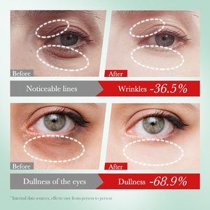 OEM SADOER Meilleures Ventes Nicotinamide Coréenne Crème <span class=keywords><strong>Yeux</strong></span> Blanchissante Éclaircissante <span class=keywords><strong>Anti</strong></span>-rides Ridules Crème <span class=keywords><strong>Yeux</strong></span> pour les <span class=keywords><strong>Cernes</strong></span> - Product Image 4