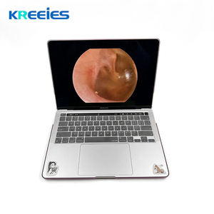 Sistema de cámara endoscópica médica portátil Usb 3,0 4K Full Hd 1080P con adaptador tipo C uso clínico humano/veterinario para artroscopio Ent - Product Image 6