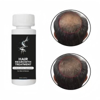 Haaröl-Fabrik OEM Kräuter 5% Konzentration Kopfhautbehandlung Haarausfall-Prävention Verdickung Reparatur 60ml für Männer und Frauen