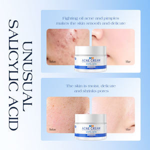 TWG RTS Salisilik Asitli Akne Karşıtı Krem, Akneli Ciltleri İyileştirir, Besler, Nemlendirir, Yüz Kremi, Sivilce İzlerini Azaltır, Akne Karşıtı Krem - Product Image 3