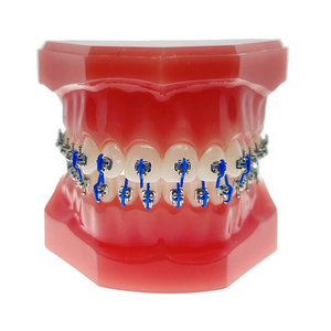 Roth chỉnh nha khung ortodoncia Brace thụ động 3G tự ligating khung - Product Image 6