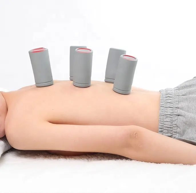Tazza di coppettazione di massaggio di vuoto di terapia sana del corpo medico cinese di massaggio di impulso di aspirazione portatile elettrico di vendita calda