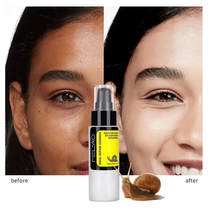 Snail Mucin 96% Essence perbaikan, 100ml Serum penghidrasi untuk wajah dengan sekresi siput esensial