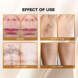 Machine d'épilation au laser diode à haute puissance médicale CE ISO13485, garantie de 2 ans, refroidissement par glace à 4 longueurs d'onde 755 808 940 1064 nm - Product Image 5