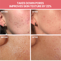 Cosmétiques de marque privée Produits pour le visage Soins de la peau Exfoliant Resserrement des pores Pastèque PHA AHA Glow Sérum Toner pour le visage Vente en gros