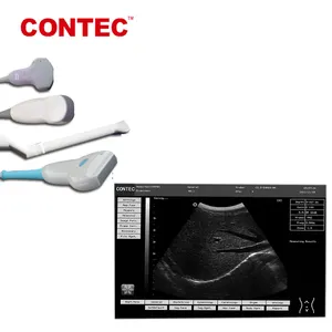 Contecmed Portable Ultrasound China Portable Ultrasonic Diagnostic Doppler Ultrasound Equipment