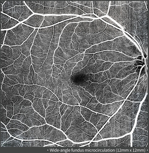 Quang học kết hợp chụp Cắt Lớp velite c808b Oct chụp động mạch Thiết bị đo thị lực thông minh dụng cụ Nhãn KhoA - Product Image 2