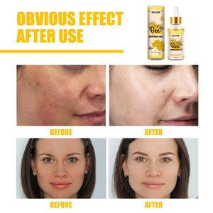 Suero facial iluminador suero facial iluminador ácido hialurónico <span class=keywords><strong>puro</strong></span> orgánico abeja <span class=keywords><strong>anticongelante</strong></span> - Product Image 4