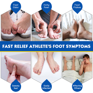 Spray <span class=keywords><strong>para</strong></span> el Pie de Atleta de Marca Privada OEM/ODM, Spray <span class=keywords><strong>Desodorante</strong></span> <span class=keywords><strong>para</strong></span> el Pie de Atleta <span class=keywords><strong>para</strong></span> el Mal Olor de los <span class=keywords><strong>Pies</strong></span>, Picazón y Sudoración - Product Image 3