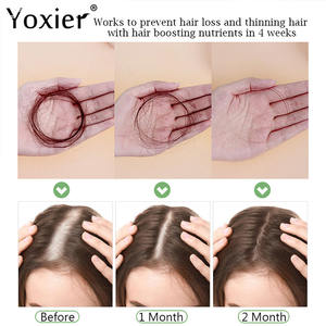 Spray de Suero Anticaída del Cabello con Jengibre, Previene la Calvicie, Repara el Cabello Dañado y Adelgazado, Favorece el Crecimiento Rápido, Cuidado Reparador del Cuero Cabelludo - Product Image 4