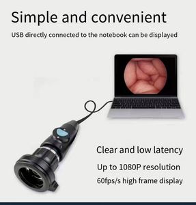 Snuke 1080p nội soi Máy ảnh xách tay hệ thống nội soi cho Ent suregery và vật nuôi nội soi - Product Image 5