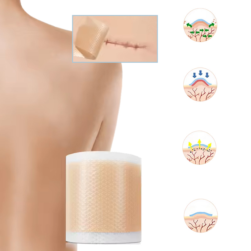 Custom Logo Medical Silicone Waterproof Adhesive Tape 4*15cm Size CE Certified Surgical Self-adhesive Tape
