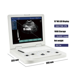 <span class=keywords><strong>Centro</strong></span> de Diagnóstico por Imágenes Médicas con Ultrasonido Veterinario, Escáner de Cardiología, Máquina de Ultrasonido Portátil tipo Laptop - Product Image 2