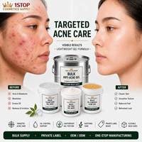 Crème Gel Onions Newpair à l'Oignon Rouge pour l'Élimination des Imperfections et l'Hydratation du Visage, Adaptée à Tous les Types de Peau, Base Gel en Gros