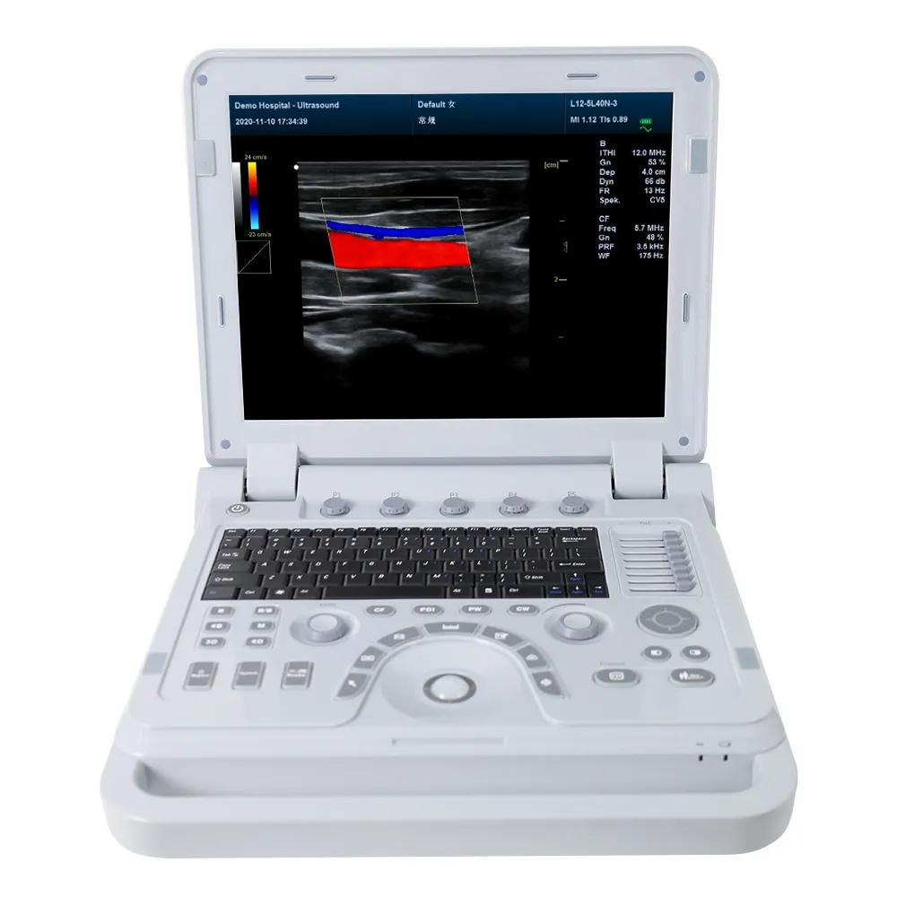 CONTEC machine à ultrasons portable couleur Doppler appareil de diagnostic à ultrasons machine d'échocardiographie