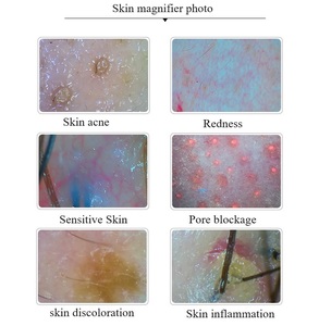 AU-958A Big Screen Clear Beauty Skin Analysis Camera Photo Analysing Machines Facial Hair Scalp Scanner - Product Image 6