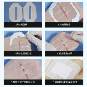 Vendaje Elástico Hons de 6cm X 8cm, Ajustable, para Fijación y Curación de Heridas - Product Image 3