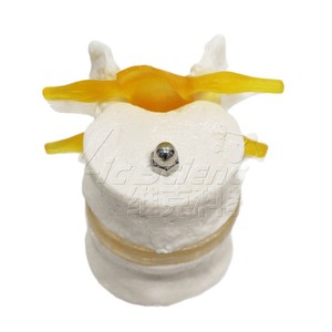 Modelo de vértebra humana de dos segmentos, material de PVC de alta precisión, estructura precisa, para demostración de patología en universidades - Product Image 5