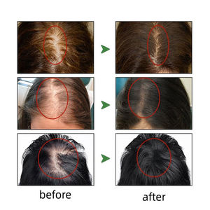 แชมพูบำรุงรากผมสูตรควบคุมความมัน ป้องกันผมร่วง บำรุงเส้นผมให้แข็งแรง ด้วยสารสกัดจากโสม สำหรับผู้ชายและผู้หญิง - Product Image 6