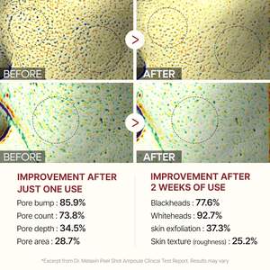 Produits de soin coréens pour le <span class=keywords><strong>visage</strong></span> en marque privée, 80 ml, sérum à base de riz pour exfolier, nettoyer et hydrater la peau, soin de la peau au riz blanc - Product Image 3