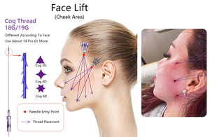 Mesotherapy Skin Tightening <strong>Blunt</strong> L <strong>Cannula</strong> 3D <strong>Cog</strong> Lifting Pdo Threads - Product Image 4