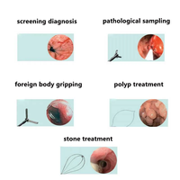 Système de caméra endoscopique médicale portable tout-en-un pour hôpital chirurgical