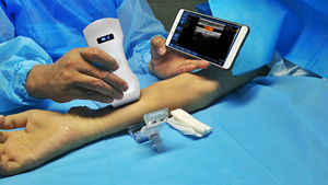 Mini cầm tay siêu Thiết bị wifi Android IOS kết nối để sử dụng nhà mang thai giám sát sức khỏe cơ bản kiểm tra máy quét - Product Image 5