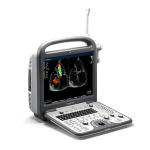 Most popular cardiac ultrasound machine Sonoscape S8 Portable Color ultrasound scanner