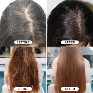 Aceite Esencial para el Cabello al Por Mayor, 100% Natural, Mejora el Frizz, Nutre el Cabello con Romero - Product Image 2