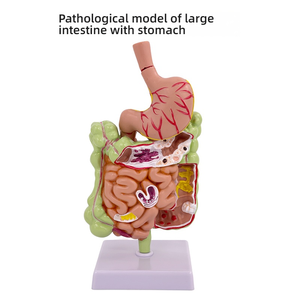 बड़ी आंत पैथोलॉजी मॉडल सिलिकॉन अंग और गैस्ट्रोइंटेस्टाइनल और कोलन रोग के लिए हेड मॉडल - Product Image 4