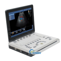 Machine de scanner d'ultrason d'écho de PC 2D humain vétérinaire de conception conviviale de grand écran avec le grand angle de vue, image claire CU09