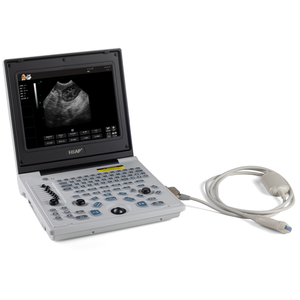 Digitale laptop-echografie voor dierenartsen, met functies voor zwangerschapsbewaking, TGC-regeling, weefselharmonieën en foetale biometrie. - Product Image 1
