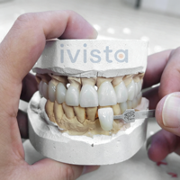 Disco de Zirconia IVISTA ST-ML Blanco de 43% de Translucidez y 1200MPa, Económico y de Color Real, para Laboratorio Dental CAD CAM