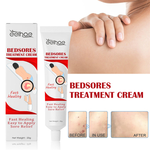 Eelhoe 20g Crema per il <span class=keywords><strong>Trattamento</strong></span> delle Piaghe <span class=keywords><strong>da</strong></span> <span class=keywords><strong>Decubito</strong></span>, Sollievo dal Dolore alle Gambe, Guarigione delle Ferite Infette, Crema per la Rimozione delle Piaghe <span class=keywords><strong>da</strong></span> Pressione - Product Image 2