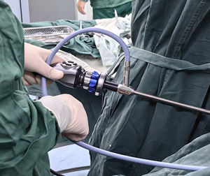 Coupleur de zoom à monture C pour <span class=keywords><strong>endoscope</strong></span> médical <span class=keywords><strong>IKEDA</strong></span> 14-35mm avec mise au point automatique pour caméra 4K UHD - Product Image 6