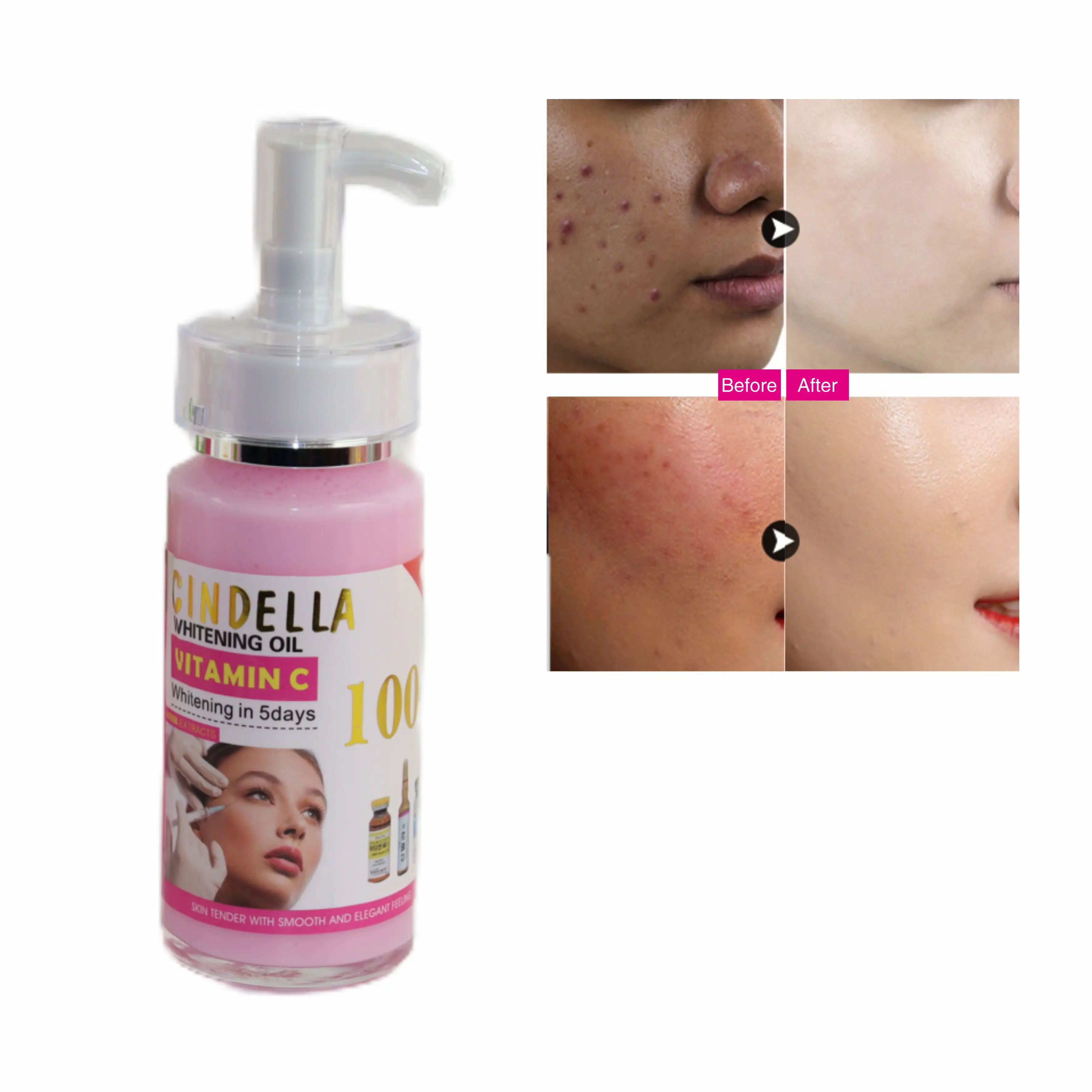 Soro branqueador de cuidados com a pele, soro branco removedor de cicatrizes acne secretos, manchas escuras, sardas, forma líquida