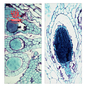 การสอนตัวอย่างที่มีโครงสร้างที่ชัดเจนรวมถึงส่วนของ * Polygonum aviculare *, antheridium และ archegonium. - Product Image 4